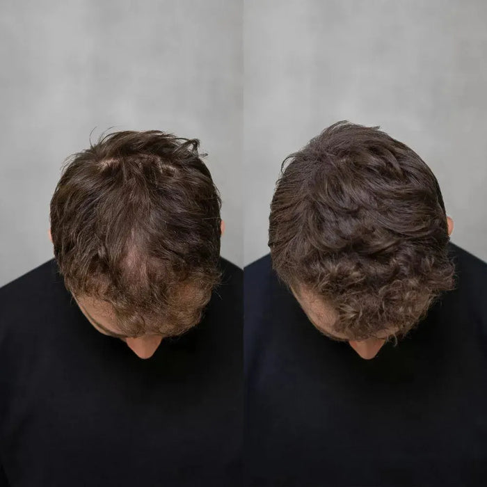 3x Keratain hair fibers + free Keratain pomade – Black (25 gr) - Hairgivers