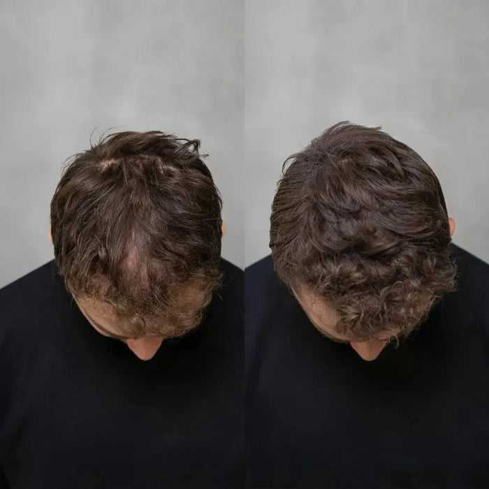 3x Keratain hair fibers + free Keratain pomade – Gray (25 gr) - Hairgivers