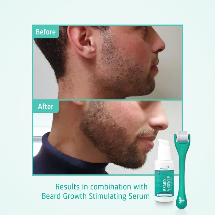 4x Neofollics beard growth serum + free beard roller