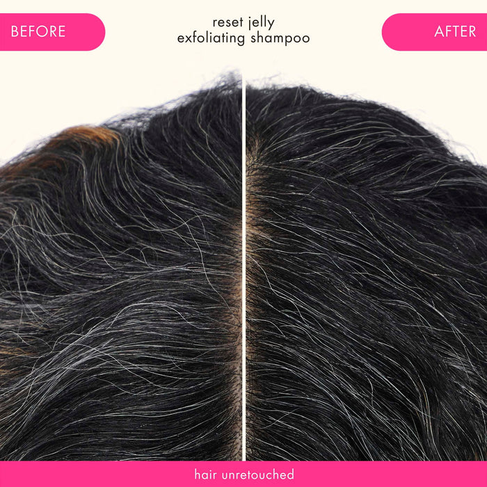 Unretouched before-and-after scalp results after using Amika Reset Exfoliating Jelly Shampoo on dark hair.