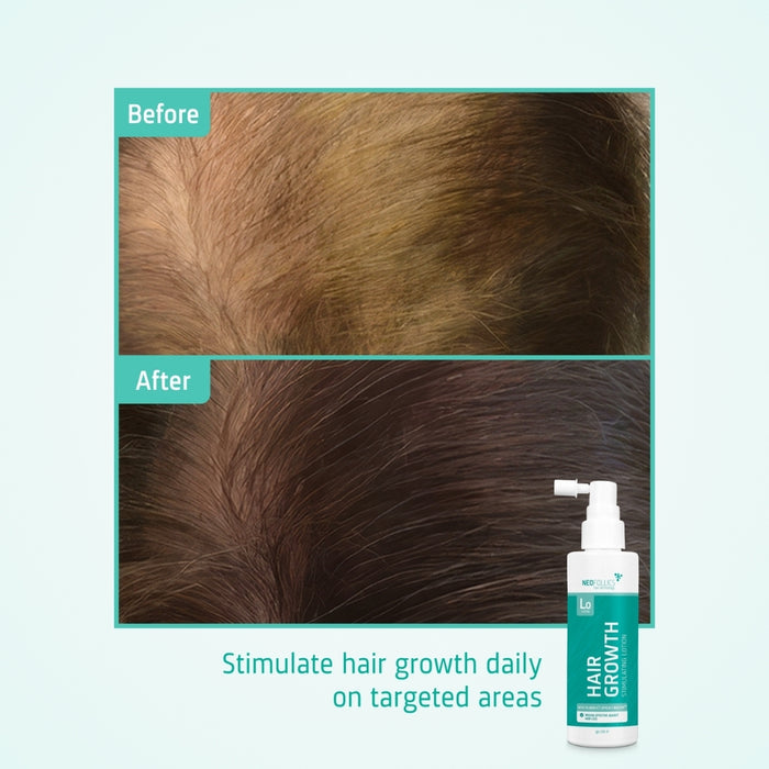 Neofollics hair growth lotion 3-pack (7% Neoxyl)