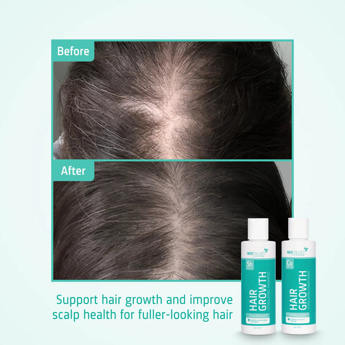 Neofollics hair growth shampoo + conditioner starter kit