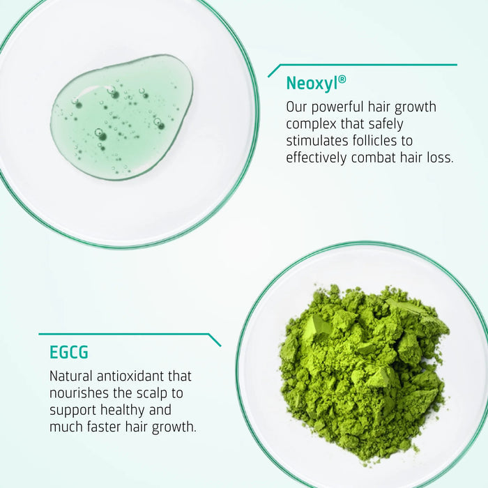 Neofollics Lotion + Scalp Roller