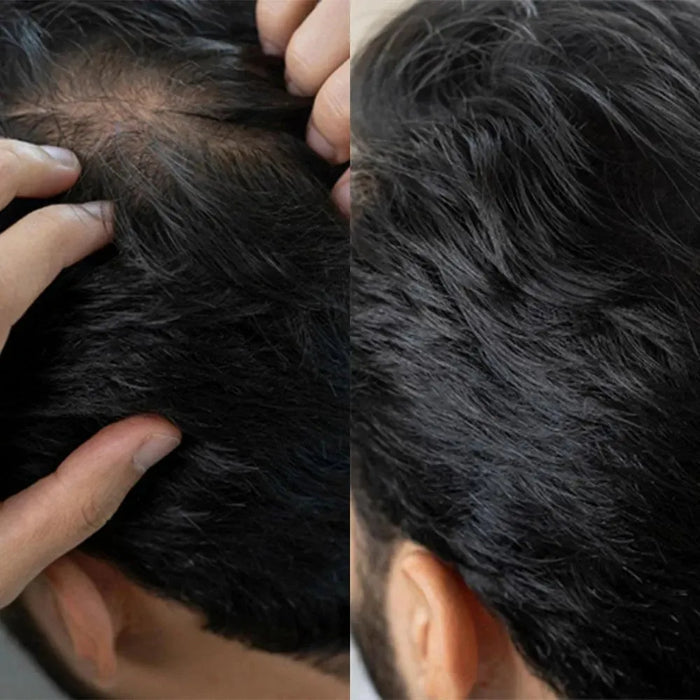 Panthrix hair growth serum (Redensyl) - Hairgivers