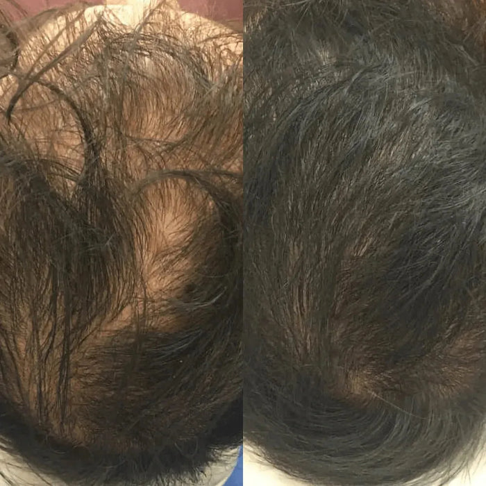 Revita hair growth shampoo + conditioner (925 ml) - Hairgivers