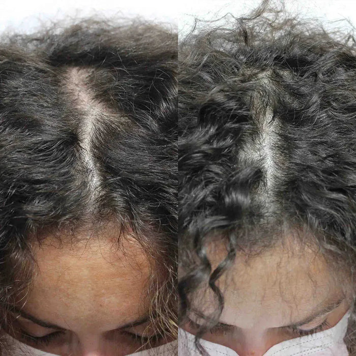 Scandinavian Biolabs hair growth treatment (women) - Hairgivers