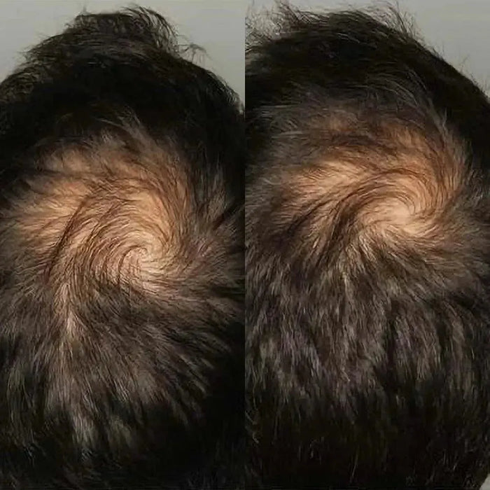 Viviscal hair growth tablets for men (3 months) - Hairgivers