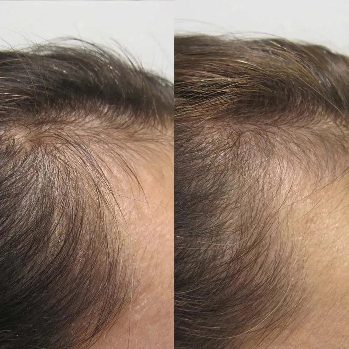 Viviscal hair growth tablets for women (1 month) - Hairgivers