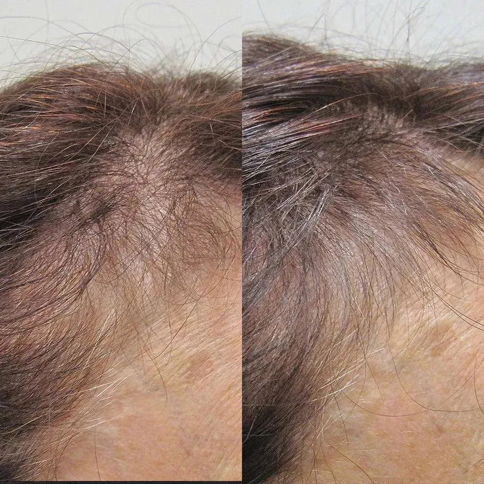 Viviscal hair growth tablets for women (1 month) - Hairgivers